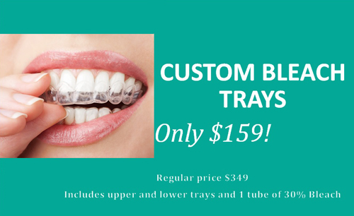 Custom Bleach Trays